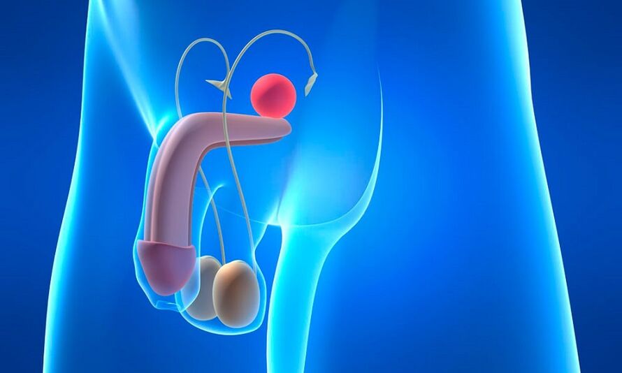 Edema de próstata con prostatitis
